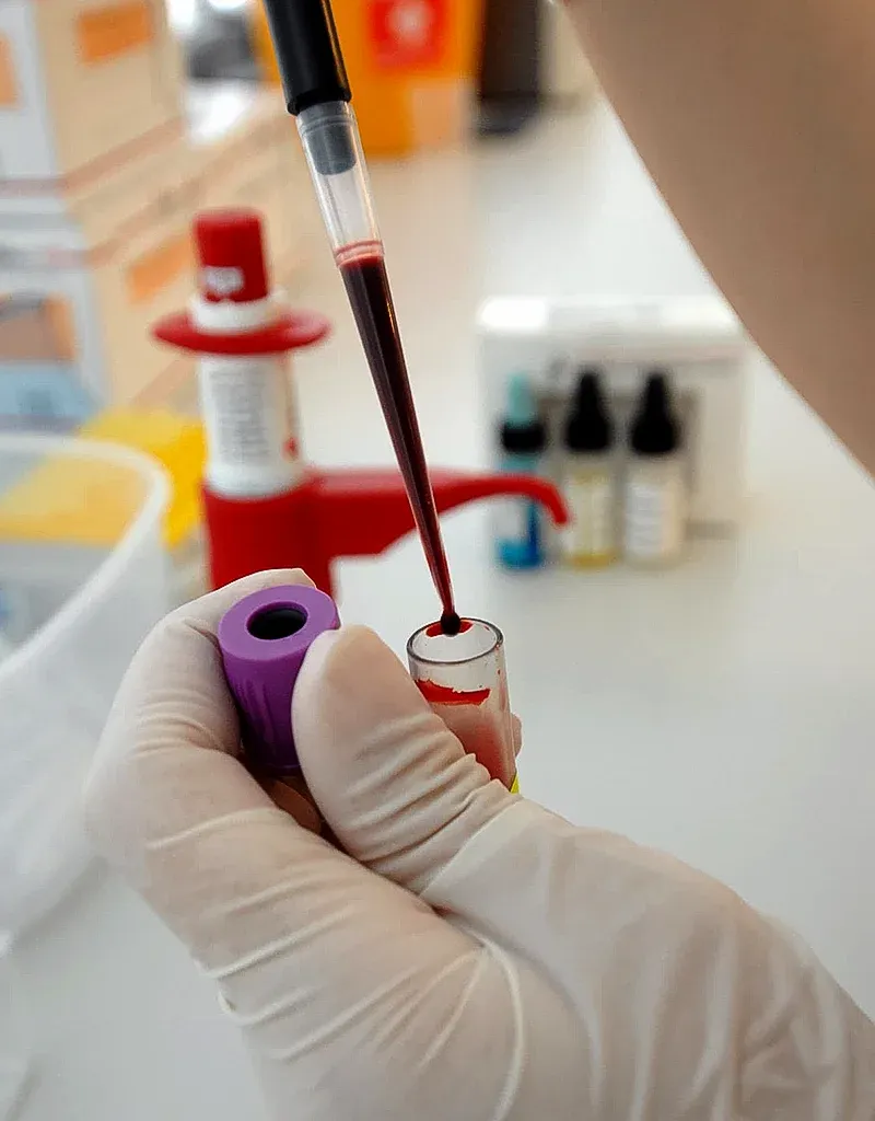 imgi_100_Blood-Tests