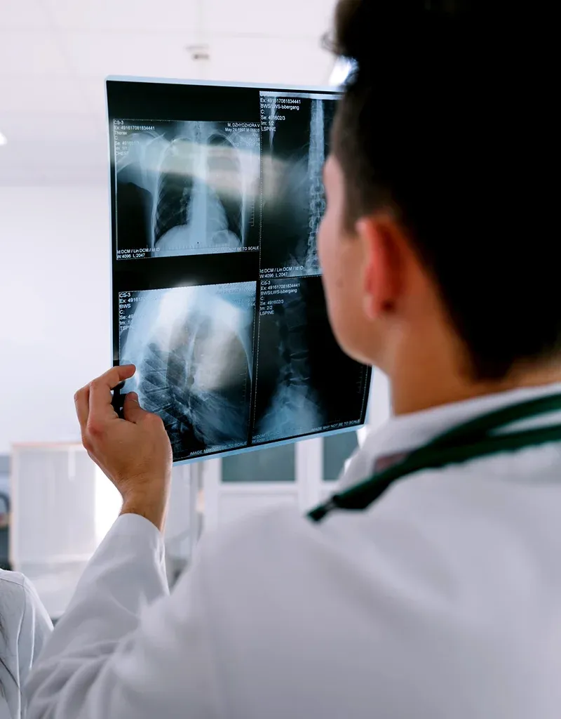 imgi_100_Types-of-X-Rays-We-Perform