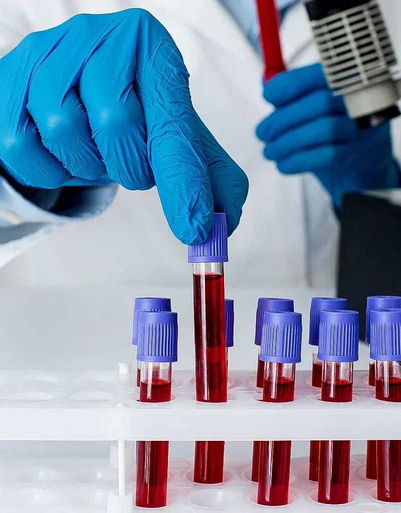 imgi_101_Specialized-Blood-Tests