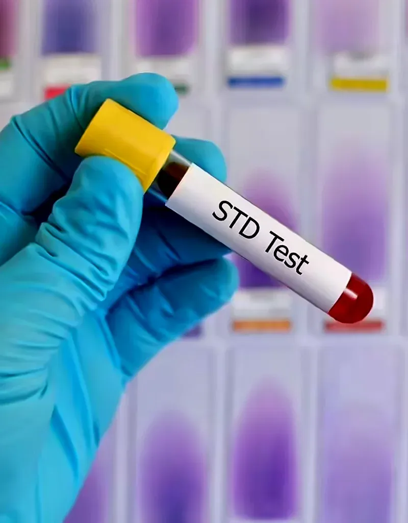imgi_181_Symptoms-That-May-Indicate-STD-Testing