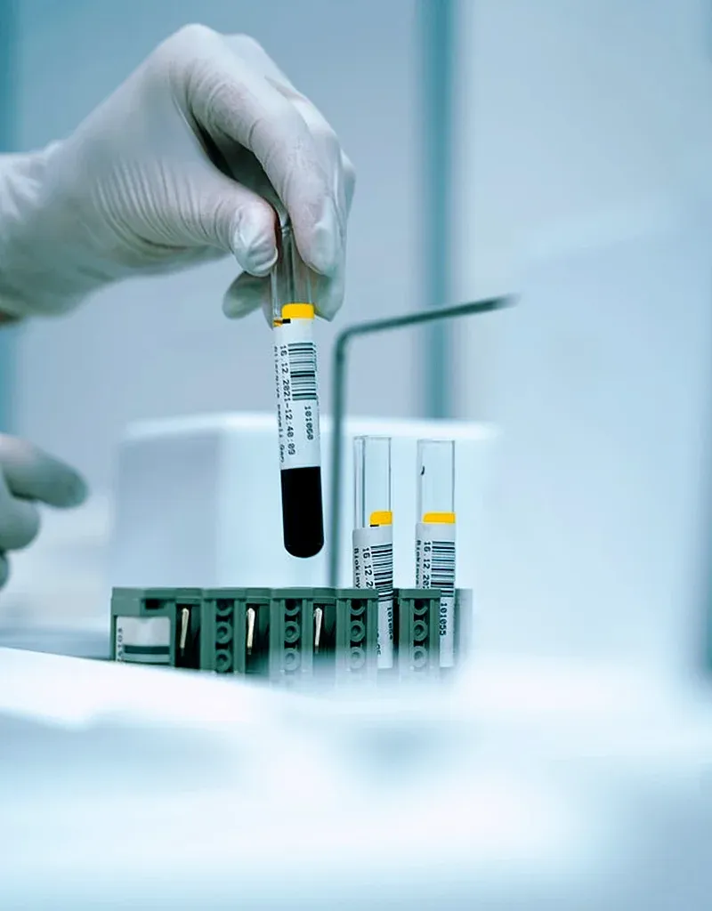 imgi_99_Our-STD-Testing-Services